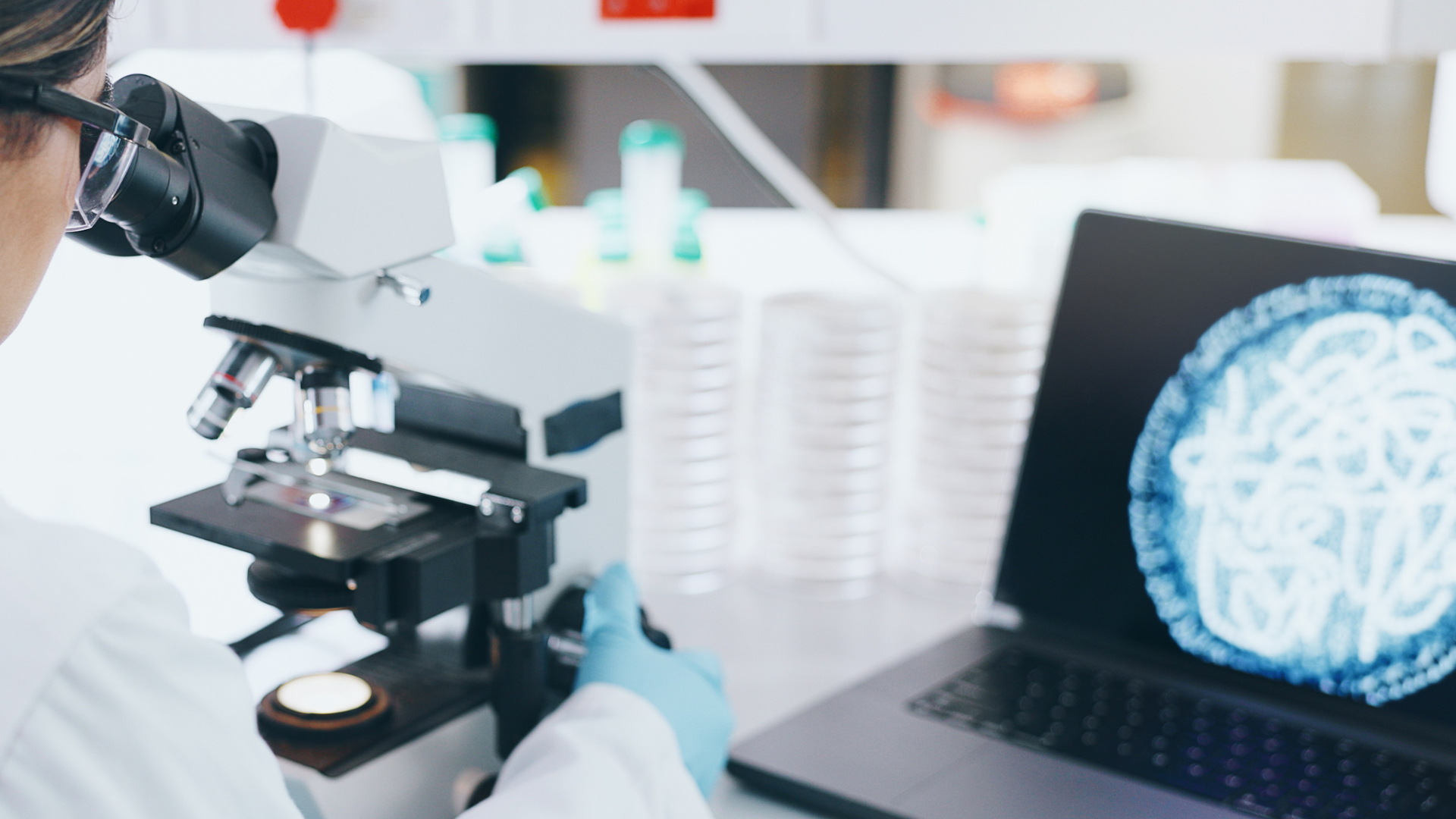 A woman in a lab coat is studying a slide under a microscope and on a computer screen in front of her she can see a dish full of microbes